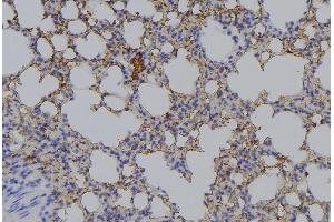 ABIN6276534 at 1/100 staining Mouse lung tissue by IHC-P. (AMACR Antikörper  (Internal Region))