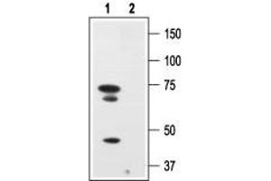 Western blot analysis of human melanoma cells A875:1. (Nerve Growth Factor Receptor (NGFR) Peptid)