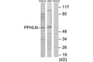 Western blot analysis of extracts from COLO/293 cells, using PPHLN Antibody. (PPHLN1 Antikörper  (AA 71-120))