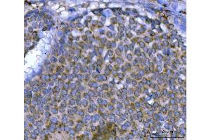IHC analysis of MSF/SEPTIN9 using anti-MSF/SEPTIN9 antibody (ABIN7600104). (Septin 9 Antikörper  (AA 15-282))