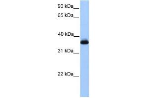 ERI2 antibody used at 1 ug/ml to detect target protein. (ERI2 Antikörper  (Middle Region))