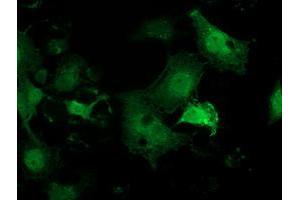 Anti-PNMT mouse monoclonal antibody (ABIN2454537) immunofluorescent staining of COS7 cells transiently transfected by pCMV6-ENTRY PNMT (RC206586). (PNMT Antikörper)