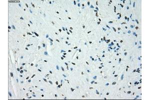 Immunohistochemical staining of paraffin-embedded endometrium tissue using anti-KDM4C mouse monoclonal antibody. (KDM4C Antikörper)