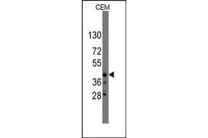 Image no. 1 for anti-Protein Quaking (QKI) (N-Term) antibody (ABIN357831) (QKI Antikörper  (N-Term))