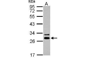 WB Image Sample (30 ug of whole cell lysate) A: A431 12% SDS PAGE antibody diluted at 1:5000