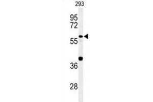 Western Blotting (WB) image for anti-Cell Division Cycle 45 Homolog (S. Cerevisiae) (CDC45) antibody (ABIN3004359) (CDC45 Antikörper)