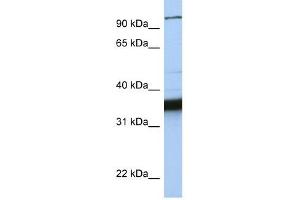 KIFC3 antibody used at 1 ug/ml to detect target protein. (KIFC3 Antikörper  (C-Term))