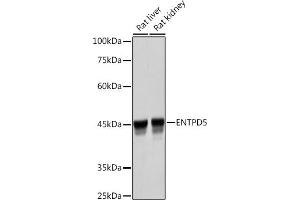 Western blot analysis of extracts of various cell lines, using ENTPD5 Rabbit mAb (ABIN7266895) at 1:3000 dilution. (ENTPD5 Antikörper)