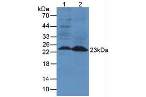 Figure. (Lipocalin 2 Antikörper  (AA 21-200))