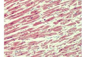 Human Heart: Formalin-Fixed, Paraffin-Embedded (FFPE) (IRAK4 Antikörper  (N-Term))