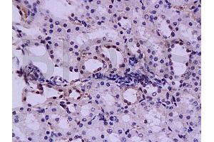 Formalin-fixed and paraffin embedded rat kidney tissue labeled with Anti-HGF Polyclonal Antibody, Unconjugated (ABIN736551) at 1:200, followed by conjugation to the secondary antibody and DAB staining (HGF Antikörper  (AA 201-300))