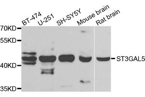 Western blot analysis of extracts of various cell lines, using ST3GAL5 antibody. (ST3GAL5 Antikörper)