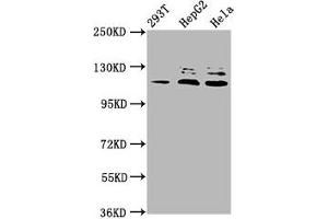 Western Blot Positive WB detected in: 293T whole cell lysate, HepG2 whole cell lysate, Hela whole cell lysate All lanes: MAP3K21 antibody at 3. (MLK4 Antikörper  (AA 640-794))