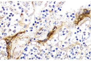 Immunohistochemistry of paraffin-embedded Human tonsil using BMPR1B Polyclonal Antibody at dilution of 1:200 (40x lens). (BMPR1B Antikörper)