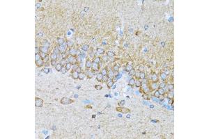 Immunohistochemistry of paraffin-embedded mouse brain using MAP1LC3B antibody (ABIN5973262) at dilution of 1/100 (40x lens). (LC3B Antikörper)
