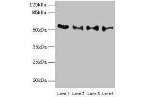 Western blot All lanes: TRIM15 antibody at 2 μg/mL Lane 1: Jurkat whole cell lysate Lane 2: Hela whole cell lysate Lane 3: HepG2 whole cell lysate Lane 4: A549 whole cell lysate Secondary Goat polyclonal to rabbit IgG at 1/10000 dilution Predicted band size: 53, 13 kDa Observed band size: 53 kDa (TRIM15 Antikörper  (AA 122-387))