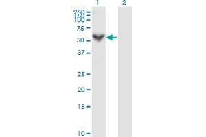 Western Blot analysis of PRF1 expression in transfected 293T cell line by PRF1 monoclonal antibody (M04), clone 3B4. (Perforin 1 Antikörper  (AA 461-555))