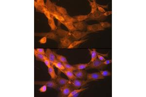 Immunofluorescence analysis of NIH-3T3 cells using tPA/tPA/PLAT Rabbit mAb (ABIN1678727, ABIN3018699, ABIN3018700 and ABIN7101650) at dilution of 1:100 (40x lens). (PLAT Antikörper)