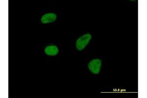 Immunofluorescence of purified MaxPab antibody to THOC3 on HeLa cell.