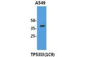 Cell lysates (40 ug) were resolved by SDS-PAGE, transferred to PVDF membrane and probed with TP53I3 antibody (1:3000). (TP53I3 Antikörper  (AA 1-332))