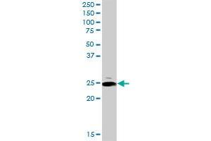 ARHGDIA MaxPab rabbit polyclonal antibody. (ARHGDIA Antikörper  (AA 1-204))