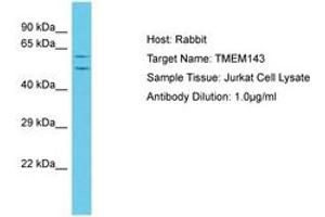 Image no. 1 for anti-Transmembrane Protein 143 (TMEM143) (C-Term) antibody (ABIN6750626) (TMEM143 Antikörper  (C-Term))