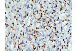 IHC analysis of LBR using anti-LBR antibody (ABIN6719340). (Lamin B Receptor Antikörper  (AA 102-209))