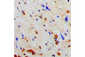Immunohistochemical analysis of NAA15 staining in human brain formalin fixed paraffin embedded tissue section. (NAA15 Antikörper  (Center))