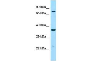 Western Blotting (WB) image for anti-Iduronidase, alpha-L- (IDUA) (C-Term) antibody (ABIN2789573)