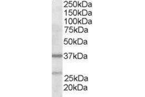 ABIN2561219 staining (2µg/ml) of Human Liver lysate (RIPA buffer, 35µg total protein per lane). (ARPC1B Antikörper  (N-Term))