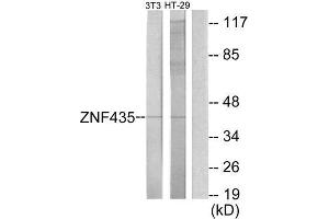 Western Blotting (WB) image for anti-Zinc Finger and SCAN Domain Containing 16 (ZSCAN16) (Internal Region) antibody (ABIN1849977) (ZSCAN16 Antikörper  (Internal Region))