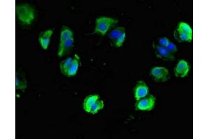 Immunofluorescent analysis of MCF-7 cells using ABIN7161314 at dilution of 1:100 and Alexa Fluor 488-congugated AffiniPure Goat Anti-Rabbit IgG(H+L) (Neuroligin 1 Antikörper  (AA 51-300))