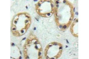 Used in DAB staining on fromalin fixed paraffin-embedded Kidney tissue (Thrombomodulin Antikörper  (AA 31-169))