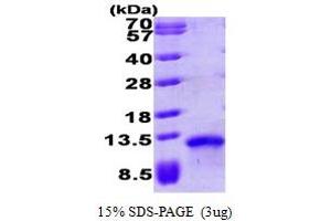 SDS-PAGE (SDS) image for Chemokine (C-C Motif) Ligand 17 (CCL17) (AA 24-94) protein (His tag) (ABIN666786) (CCL17 Protein (AA 24-94) (His tag))