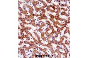 Immunohistochemistry (IHC) image for anti-Indian Hedgehog (IHH) antibody (ABIN2998360) (Indian Hedgehog Antikörper)