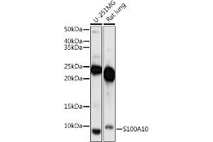 Western blot analysis of extracts of various cell lines, using S100 antibody (ABIN7270123) at 1:1000 dilution. (S100A10 Antikörper  (AA 1-97))