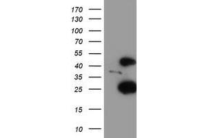 HEK293T cells were transfected with the pCMV6-ENTRY control (Left lane) or pCMV6-ENTRY CENPH (Right lane) cDNA for 48 hrs and lysed. (CENPH Antikörper)