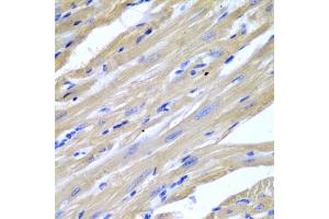 Immunohistochemistry of paraffin-embedded mouse heart using HSPB2 antibody (ABIN5971309) at dilution of 1/200 (40x lens).