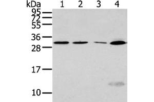 Gel: 12 % SDS-PAGE, Lysate: 40 μg, Lane 1-4: Hela, Jurkat and hepg2 cell, human fetal liver tissue, Primary antibody: ABIN7128017(SIAH1 Antibody) at dilution 1/300 dilution, Secondary antibody: Goat anti rabbit IgG at 1/8000 dilution, Exposure time: 1 minute