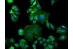 Immunofluorescence (IF) image for anti-Epidermal Growth Factor Receptor (EGFR) antibody (Alexa Fluor 488) (ABIN2657498) (EGFR Antikörper  (Alexa Fluor 488))