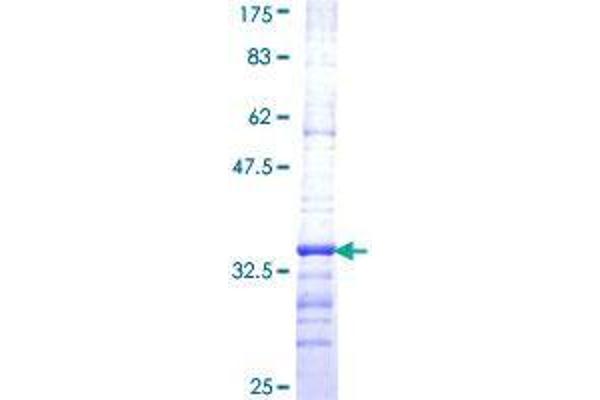EID1 Protein (AA 116-187) (GST tag)