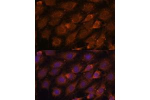 Immunofluorescence analysis of C6 cells using CREB3 antibody (ABIN6128862, ABIN6139013, ABIN6139015 and ABIN6222241) at dilution of 1:100. (CREB3 Antikörper  (AA 1-230))
