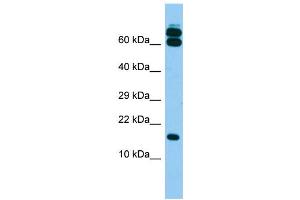 Host: Rabbit Target Name: B9D2 Sample Type: Fetal Brain lysates Antibody Dilution: 1. (B9D2 Antikörper  (N-Term))