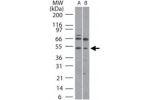 Western blot analysis of RUNX1 in (A) human Ramos and (B) mouse Raw cell lysate using RUNX1 polyclonal antibody  at 5 ug/mL . (RUNX1 Antikörper  (AA 231-245))