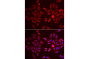 Immunofluorescence analysis of U2OS cells using PDK4 antibody (ABIN5971569). (PDK4 Antikörper)