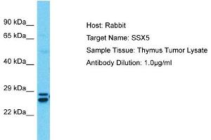 Host:  Rabbit  Target Name:  SSX5  Sample Type:  Thymus Tumor lysates  Antibody Dilution:  1.