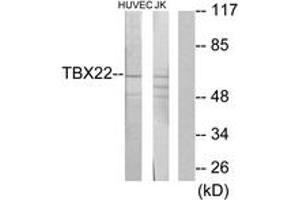 Western blot analysis of extracts from Jurkat/HuvEc cells, using TBX22 Antibody. (T-Box 22 Antikörper  (AA 1-50))