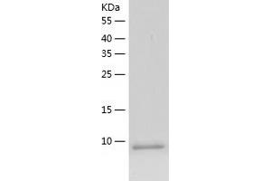 Cystatin B (Stefin B) (CSTB) (AA 1-98) protein (His-IF2DI Tag)