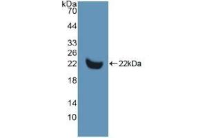 Detection of Recombinant MMP13, Human using Polyclonal Antibody to Matrix Metalloproteinase 13 (MMP13) (MMP13 Antikörper  (AA 290-468))