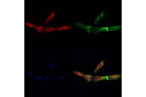 C1orf163 Antibody staining Hela cells by IF/ICC. (C1orf163 Antikörper  (Internal Region))
